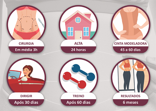 Prazos de retorno às principais atividades, após abdominoplastia clássica