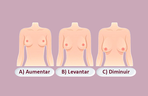 O que você gostaria de melhorar nos seus seios